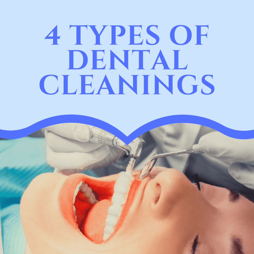 4 cleaning types