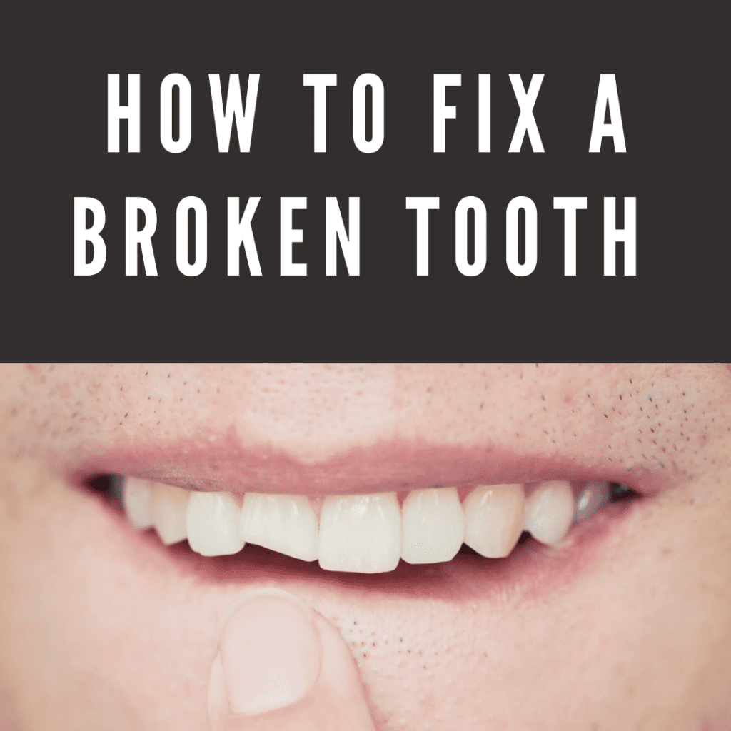 How to Fix a Broken Tooth
