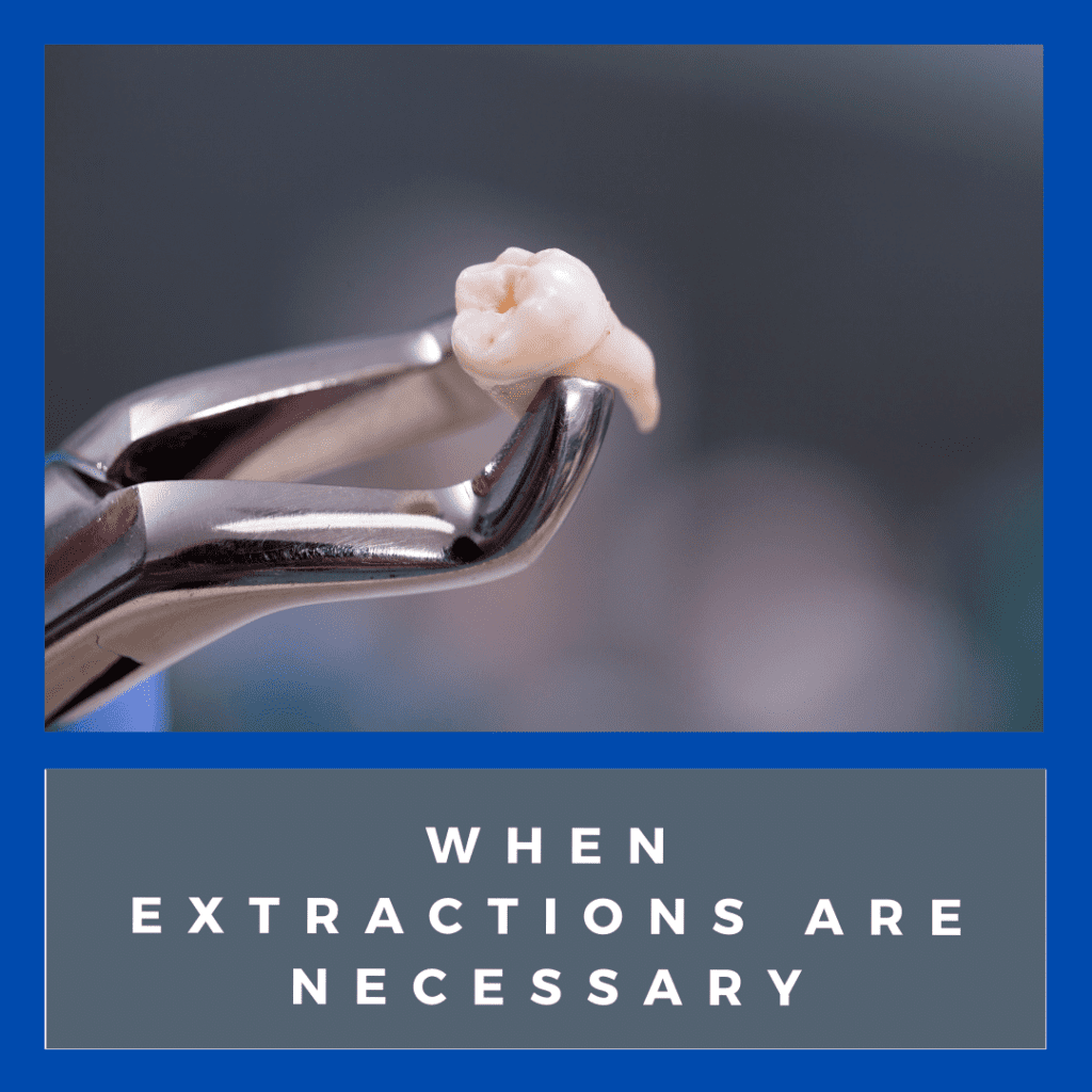When Extractions are Necessary (1)