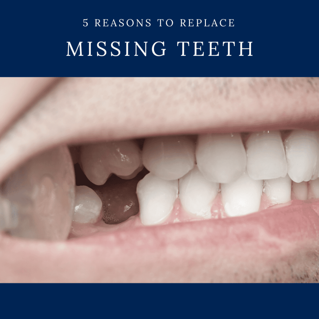 5 Reasons to replace missing teeth