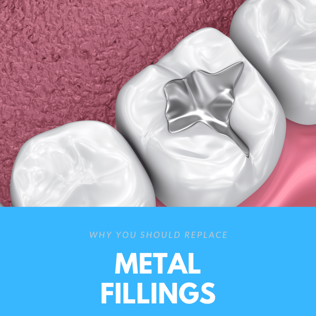 Why You Should Replace Metal Fillings