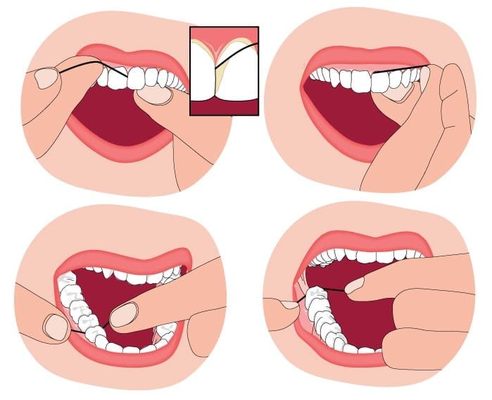 diagram showing how to floss