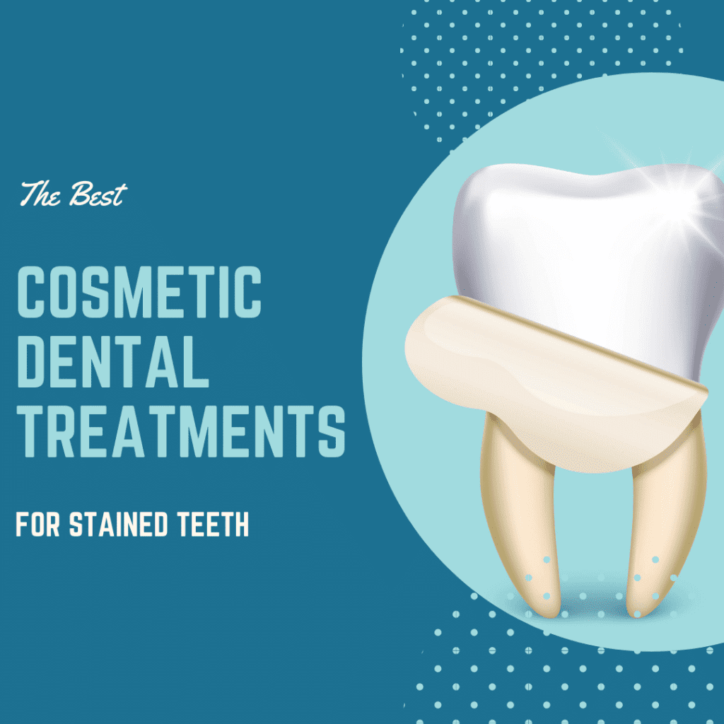 The Best Cosmetic Dental Treatments for Stained Teeth