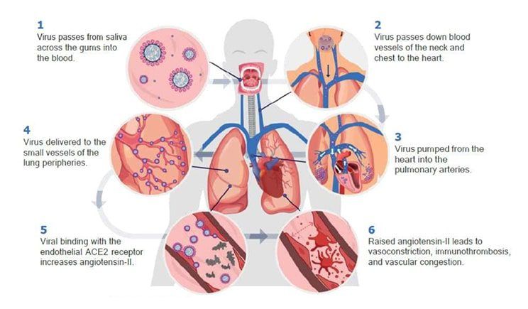 how COVID reaches the lungs through the bloodstream
