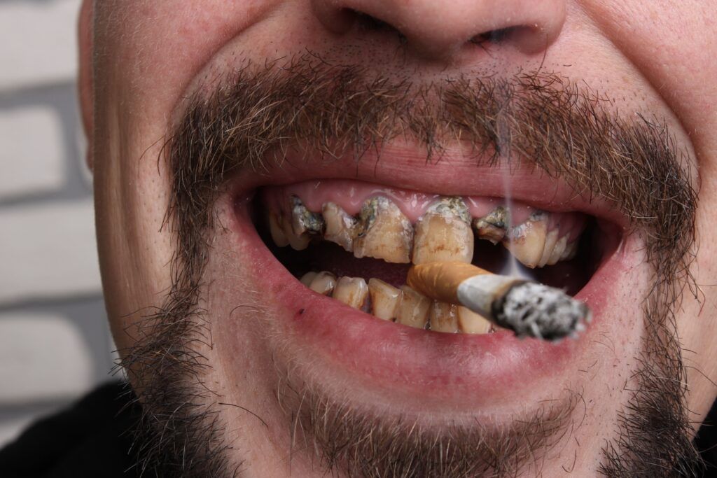 smoking man with stained teeth