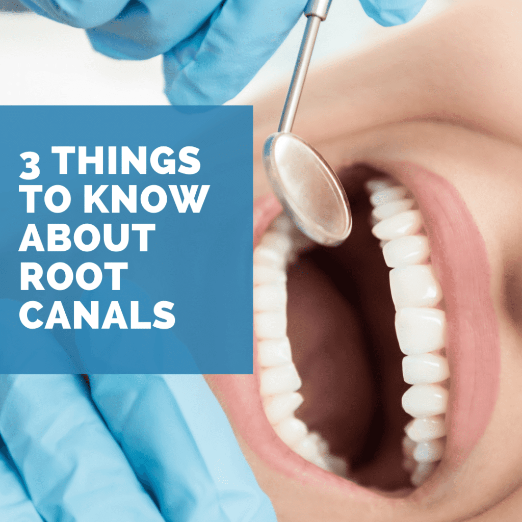 3 Things to Know About root Canals (1)