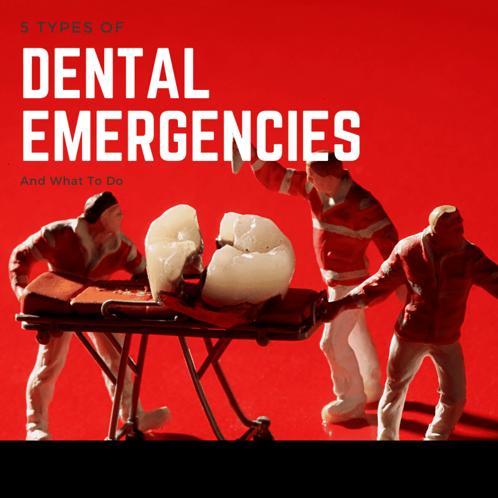 5 Types of dental emergencies and what to do (1)